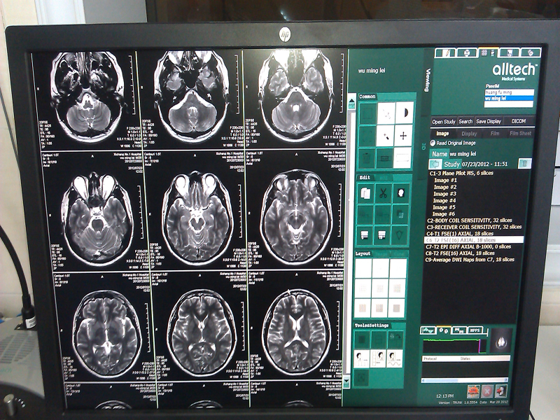 我院最新引进奥泰核磁共振成像系统(mri)